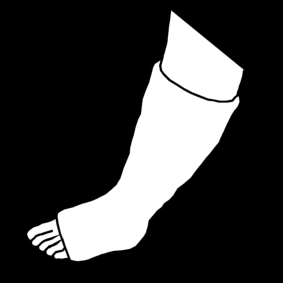 broken leg